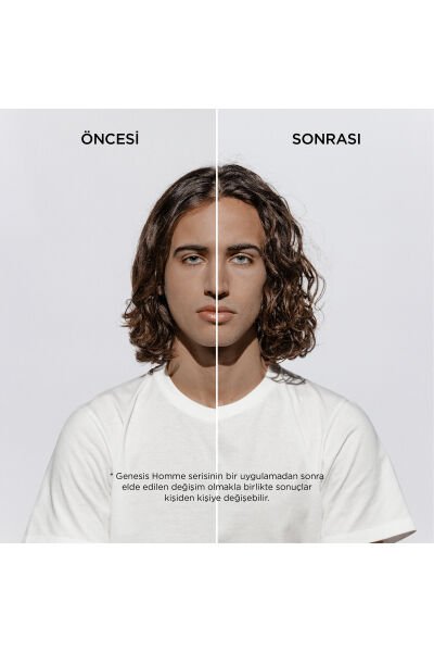 Genesis Homme Saç Dökülme Karşıtı Güçlendirici Serum 90 ml