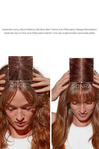 Symbiose Kepek Karşıtı Hücresel Mikro-Peeling 200 ml